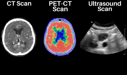 X-Ray, Ultrasound, CT and MRI