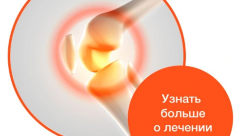глюкозамин сульфат